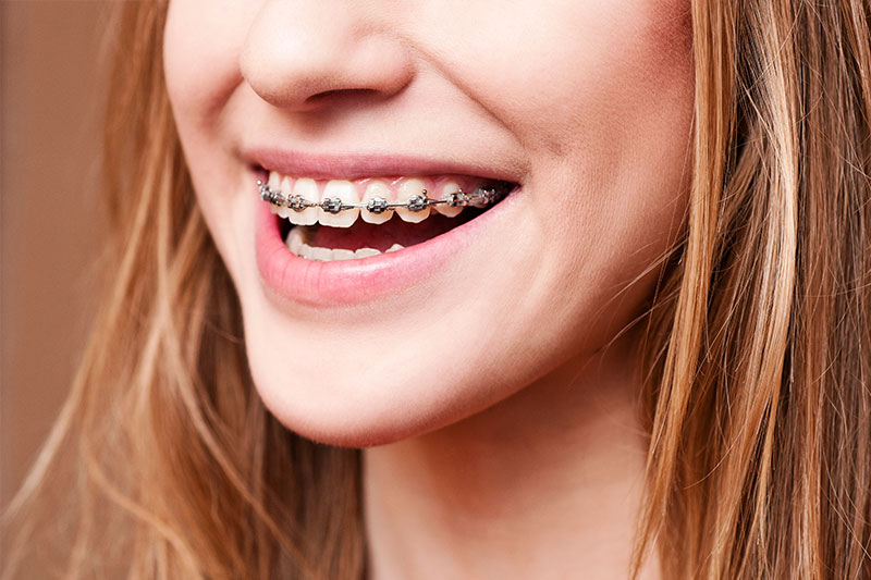 Orthodontics in Pflugerville